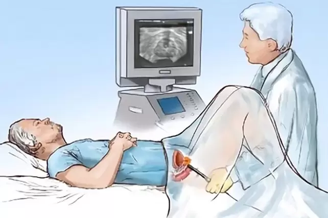 diagnosi di prostatite